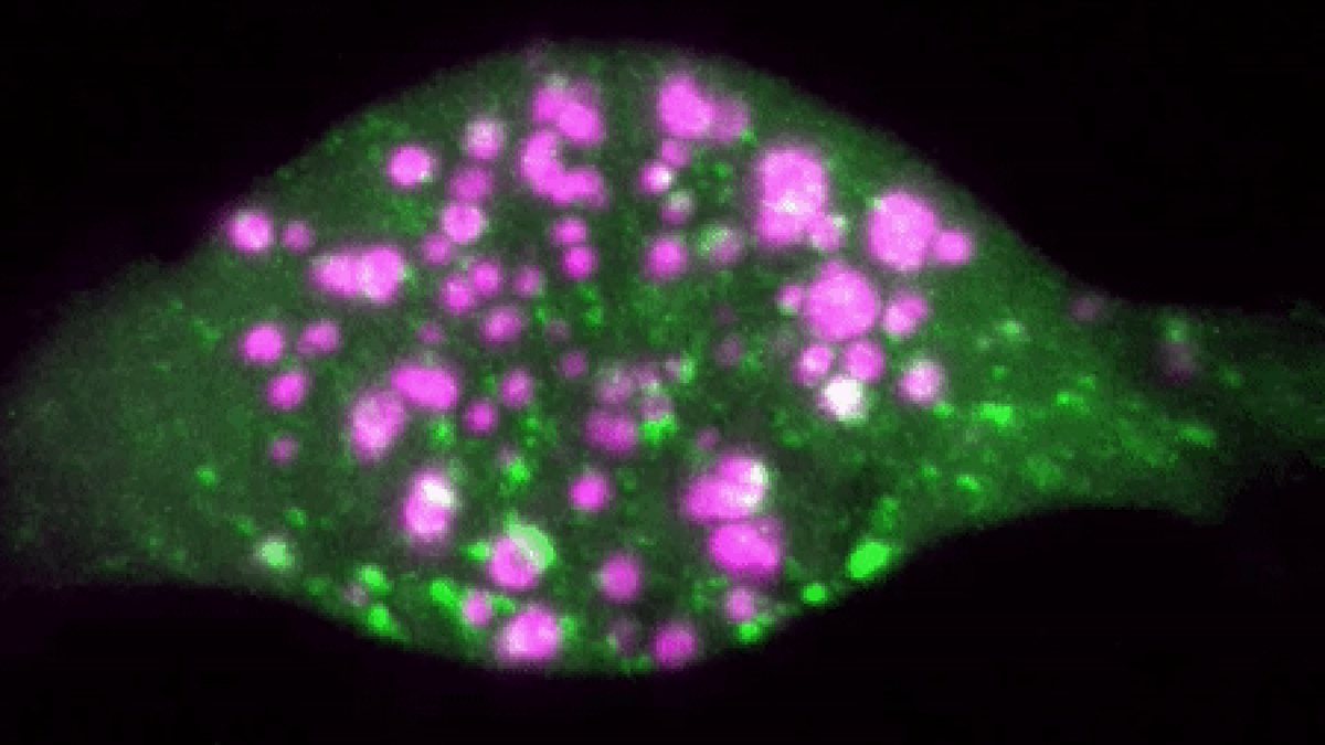Fluorescence microscopy of a cell showing cytoplasmic RNA condensates in magenta and green