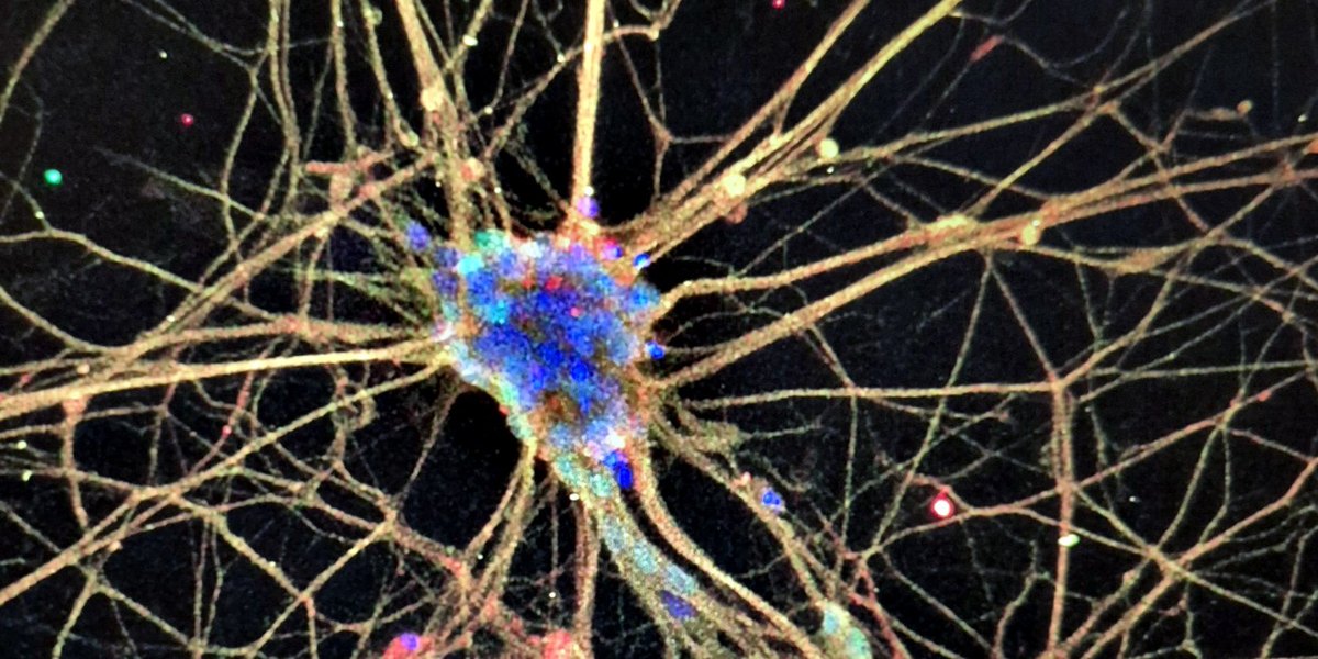 Immunofluorescence image of a stem cell-derived neuron expressing dCas9, with branching neurites